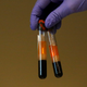 Illustration for article titled Does Your Blood Type Affect Your Risk of Covid-19?